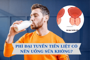 Phì đại tuyến tiền liệt nên hạn chế những loại sữa có nhiều chất béo